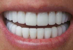 10 Be ready by having a bright and white-teeth smile